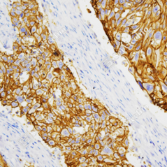 Recombinant Anti-Claudin 1...