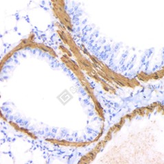 Anti-alpha smooth muscle...
