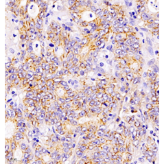 Anti-Claudin 1 Rabbit pAb,...