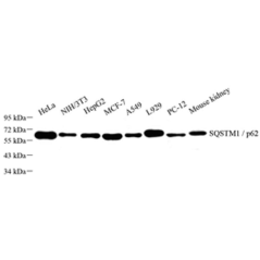 Anti-SQSTM1/p62 Rabbit pAb,...