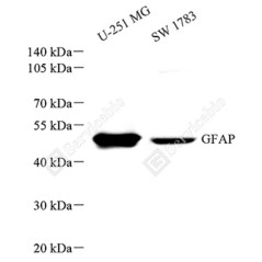 Recombinant Anti-GFAP...