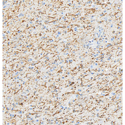 Anti-Nestin Rabbit pAb, Primary Antibody