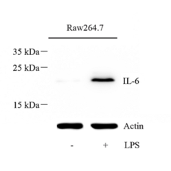 Anti-IL-6 Rabbit pAb, Primary Antibody
