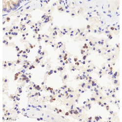 Anti-IL-6 Rabbit pAb, Primary Antibody