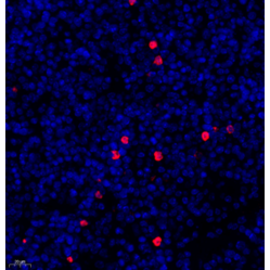 Anti-IL-6 Rabbit pAb, Primary Antibody