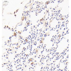 Anti-Mannose Receptor/CD206 Rabbit pAb, Primary Antibody