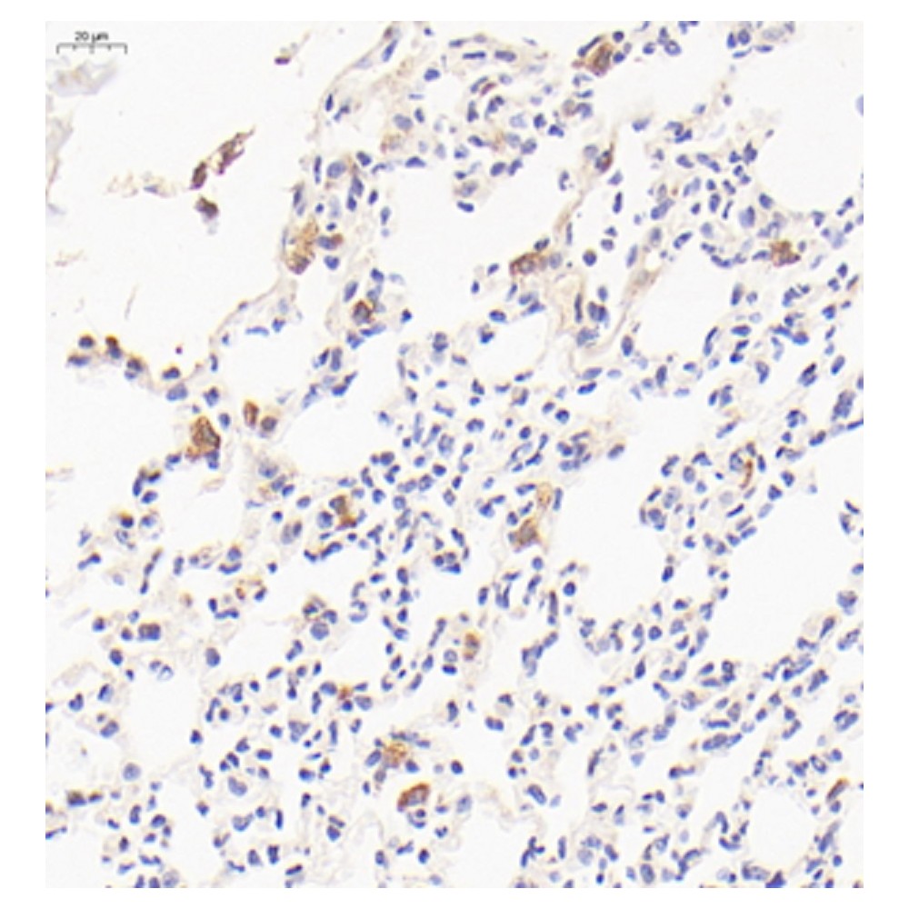 Anti-Mannose Receptor/CD206 Rabbit pAb, Primary Antibody