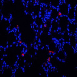 Anti-Mannose Receptor/CD206 Rabbit pAb, Primary Antibody