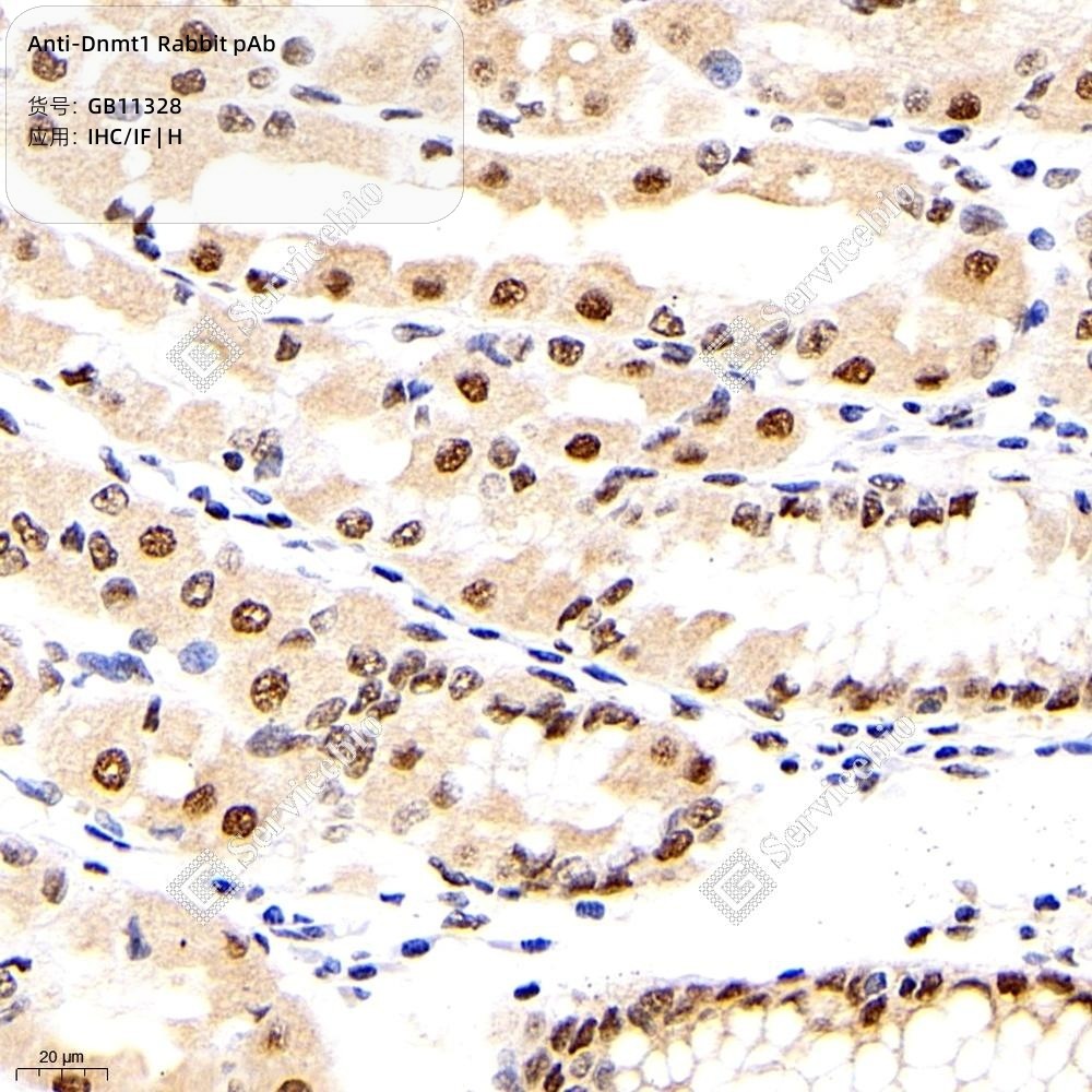 Anti-Dnmt1 Rabbit pAb, Primary Antibody