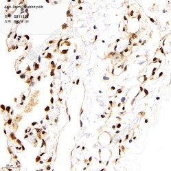 Anti-Dnmt1 Rabbit pAb, Primary Antibody