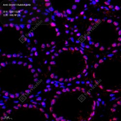 Anti-Dnmt1 Rabbit pAb, Primary Antibody