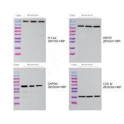 PVDF membrane (0.45 μm)