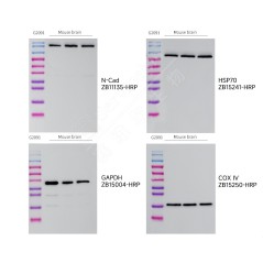 PVDF membrane (0.45 μm)