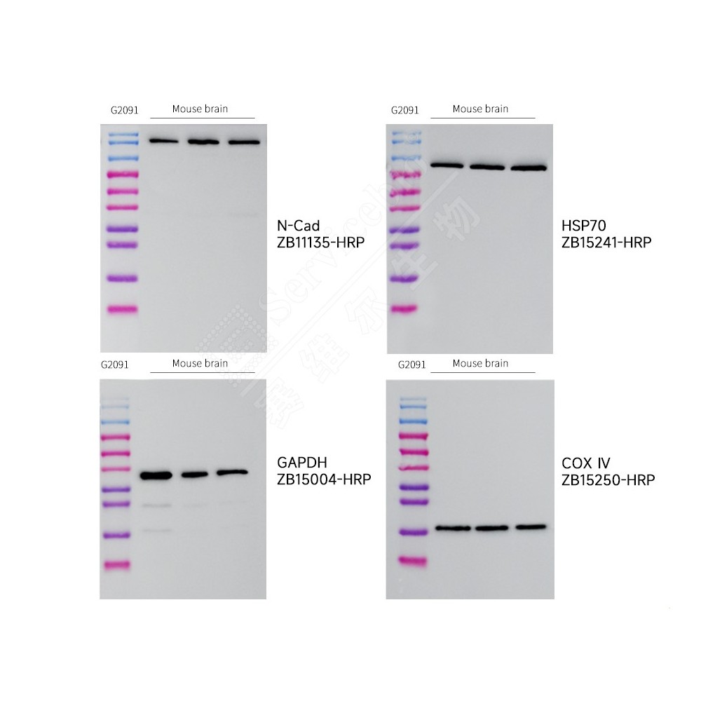 PVDF membrane (0.45 μm)