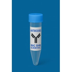 Anti-UHRF1 mAb, Primary...