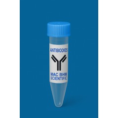 Anti-UHRF1 mAb, Primary...