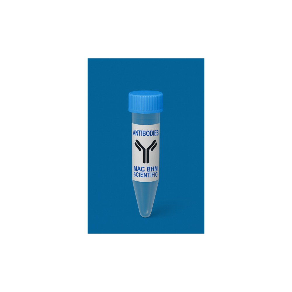 Anti-UHRF1 mAb, Primary Antibody