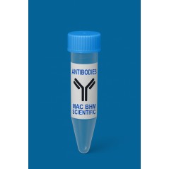 Recombinant Anti-CDX2...