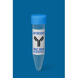 Recombinant Anti-beta Catenin antibody (Rabbit mAb), Primary Antibody