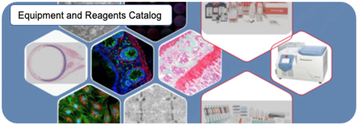 Antibody anticorps antibodies.png